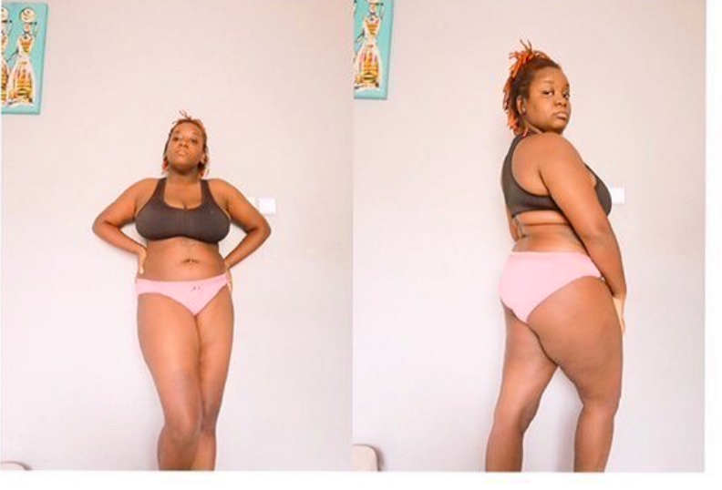 Young Lady Celebrates Her Body After 13 Months Of Continuous Menstruation